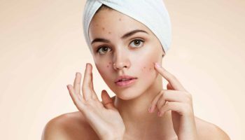Le CBD contre l'acné, un traitement efficace?